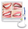 Picture of Appledent Dental Intra Oral Camera Wifi With 17″ inch Led Monitor With 12 Months Warranty