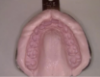 Picture of Alginate Impressions Material  ACCUREX - 1126 gms