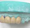 Picture of Appledental Zirconia Blanks ST-White Ф98*12 mm