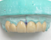 Picture of Appledental Zirconia Blanks ST-White Ф98*12 mm