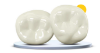 Picture of Permanenant Molars Starter Kit - Contains 16 Crowns
